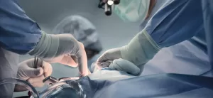 Rib Is Not Broken in Closed Bypass Surgery