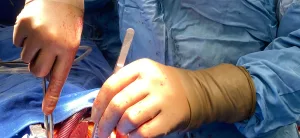 Koltuk Altı (Minimal İnvaziv) Aort Anevrizma Tedavisinin Avantajları Nelerdir?