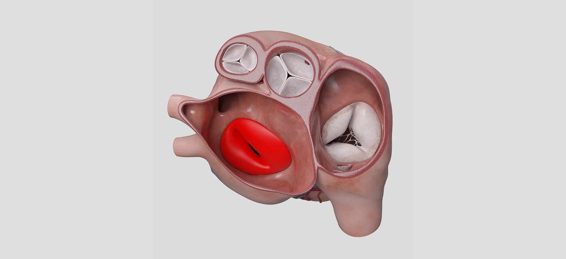 Mitral Kapak Nedir? İşlevi Nedir?